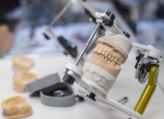 Nowoczesne implanty zębowe w służbie pięknego uśmiechu