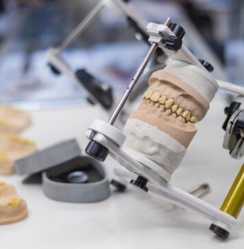 Nowoczesne implanty zębowe w służbie pięknego uśmiechu